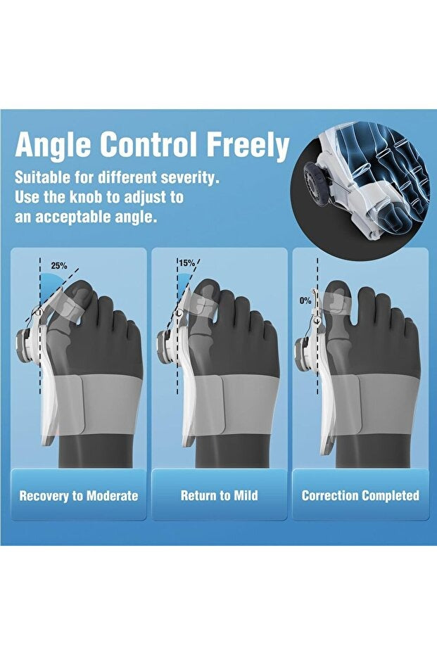 Toe-X® Halluks Valgus Ateli